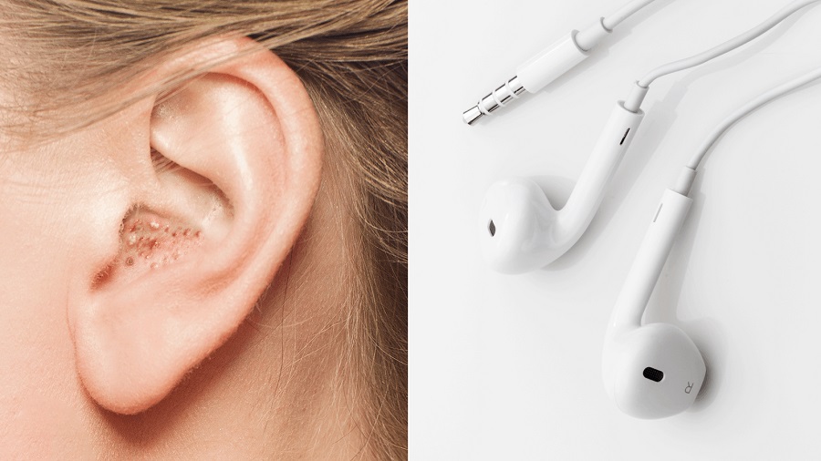 Đeo tai nghe có thể là nguyên nhân dẫn đến tình trạng nhiễm khuẩn tai